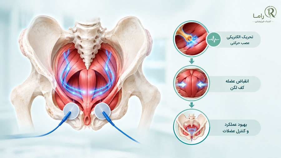 عملکردهای الکتروتراپی و تحریک الکتریکی کف لگن 