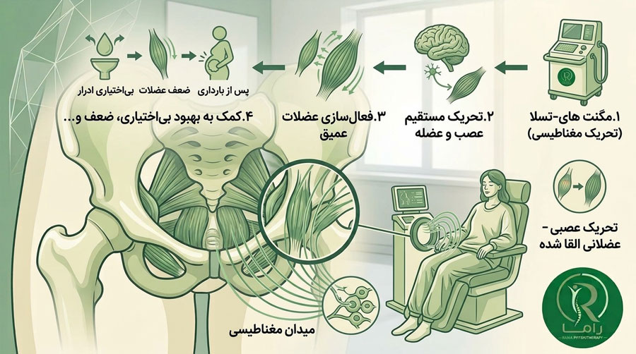 روند کار و تاثیر مگنت های-تسلا در فیزیوتراپی کف لگن